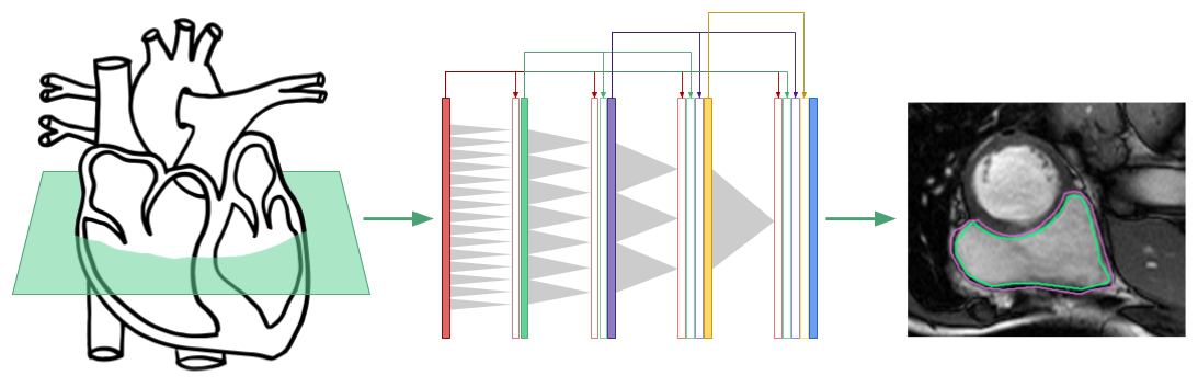 Cardiovascular Imaging with Deep Learning